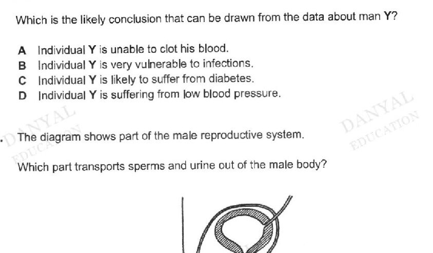 A table showing blood counts comparison: white blood cells (X: 8 x 10^9, Y: 3 x 10^5), red blood cells (X: 5 x 10^12, Y: 5.5 x 10^12), platelets (X: 300, Y: 310)
