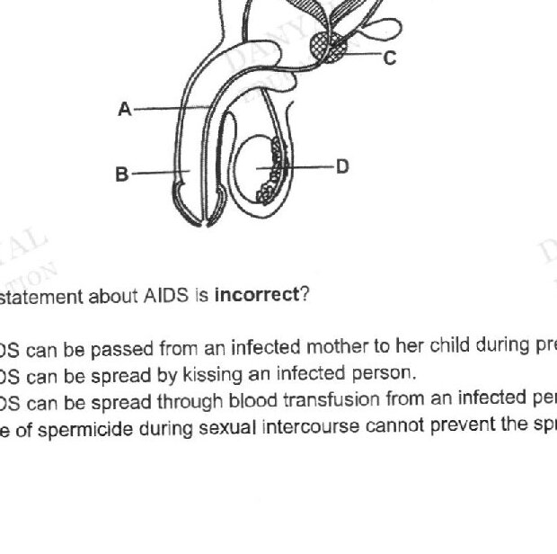 A diagram of the male reproductive system showing four labeled parts: A (appears to be the vas deferens), B (appears to be the urethra), C (appears to be the bladder), and D (appears to be the prostate gland or seminal vesicle). The structure shows the relationship between these organs.